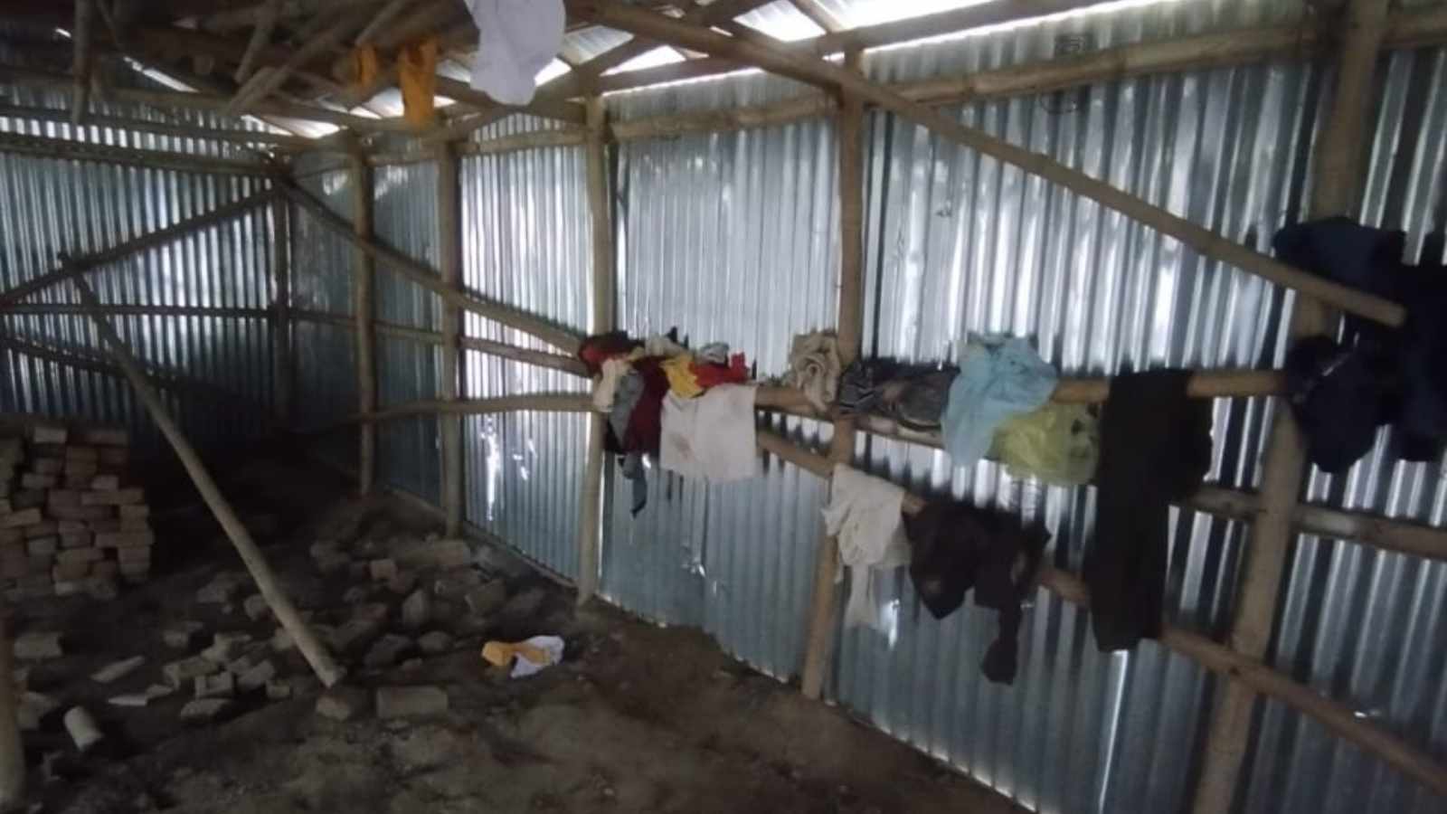 After acid attack, conflicting accounts and a Jharkhand family are still waiting for justice, reconstruction surgery. Bharat News